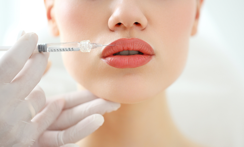 A woman receiving a lip filler injection