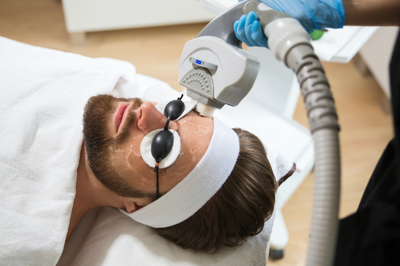 A man receiving laser facial rejuvenation